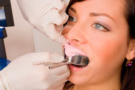 Clínica Dental Quintás tomando impresión de dientes 