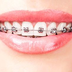 Clínica Dental Quintás ortodoncia 